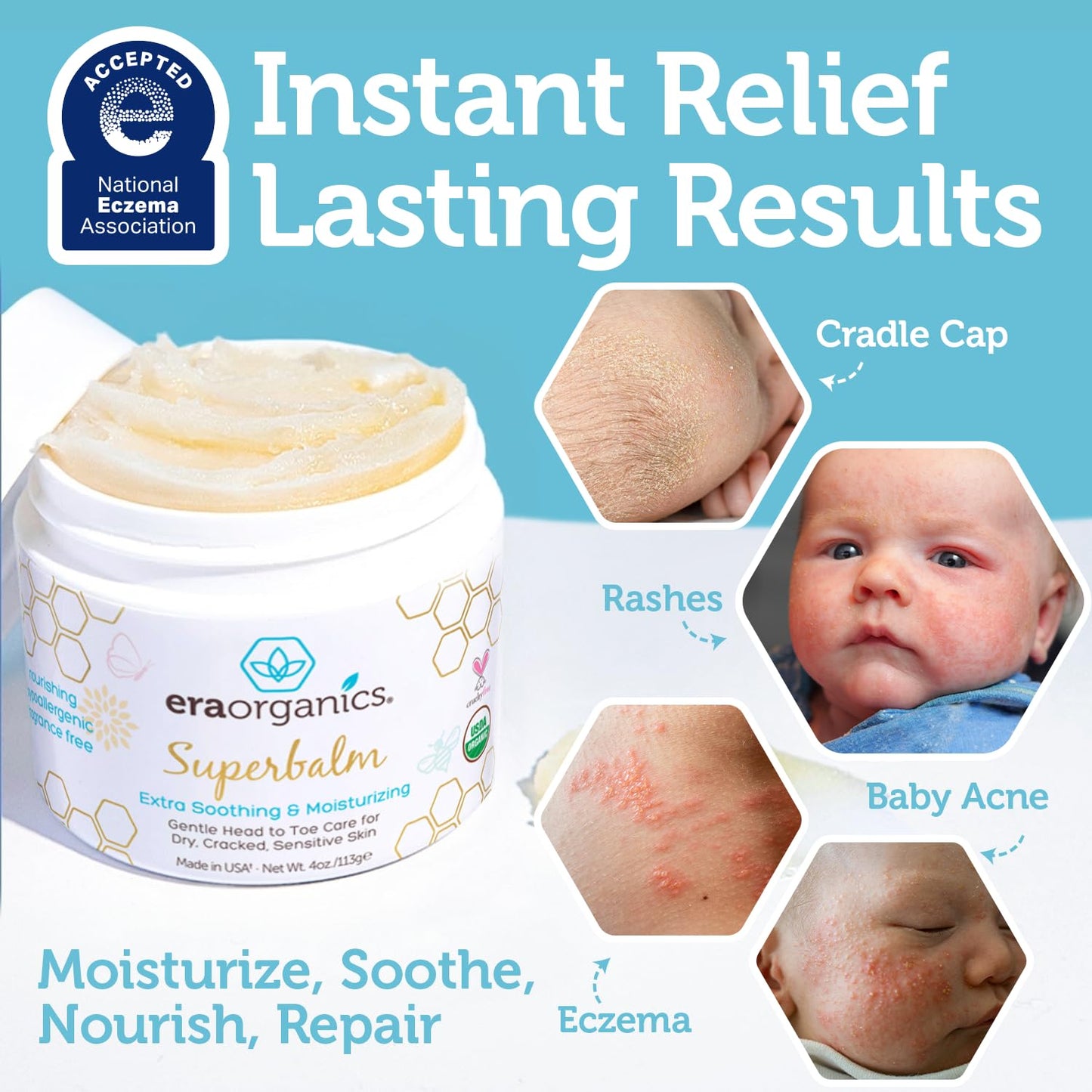 Era Organics Healing Ointment for Babies - USDA Certified Organic Natural Moisturizer Gentle on Sensitive Skin Prone To Baby Eczema, Cradle Cap (Infant Seborrheic Dermatitis), Rashes, Hives 4oz