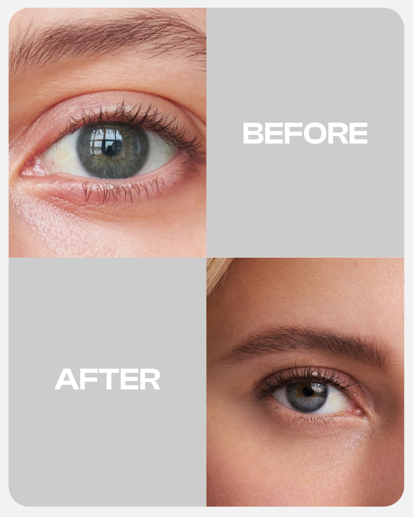 Nutracosmetic NutraBrow Eyebrow Enhancer - Eyebrow Growth Serum for Thicker Brows in 8-12 Weeks I Eyebrow Serum to Grow Brows I Made in Germany I 3ml