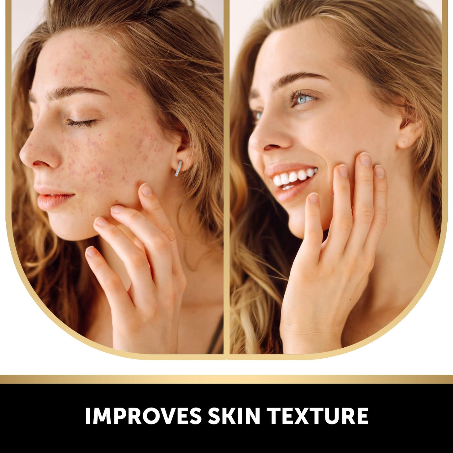 VALITIC Kojic Acid Soap for Hyperpigmentation - with Glutathione, Collagen & Vitamin C - Advanced Soap Bars with Turmeric - Original Japanese Complex for Dark Spot Correction - 3 Pack