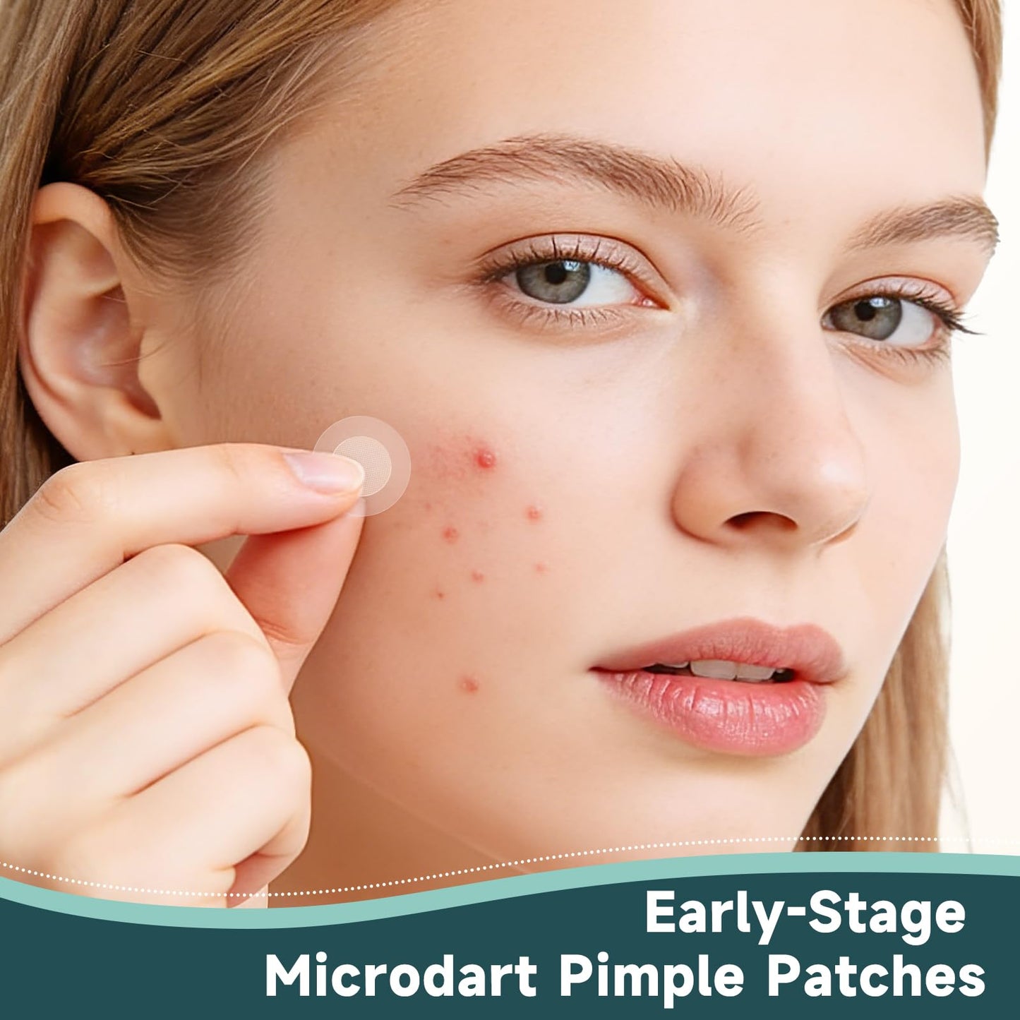 Microdart Pimple Patches for Face 9 Count,Hydrocolloid Acne Patches,for Early Stage Zits ,Spot Patch with 395 Microdart