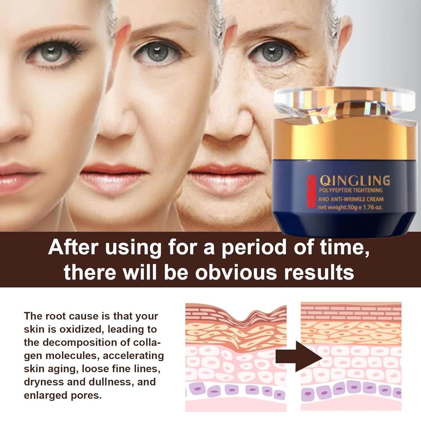 JINMAO Qingling Face Cream, Qingling Wrinkle Removal Cream, Quinglin Polypeptide Tightening and Anti-Wrinkle Moisturizer, Face & Neck & Eye Lotion 3-In-1 (1)