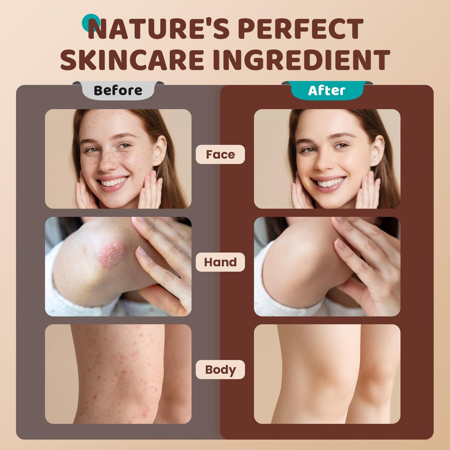 Choido Tallow and Honey Balm, Beef Tallow for Skin, Whipped Organic Grass-Fed Beef Tallow, Natural Whipped Face Moisturizer & Body Butter for Dry & Sensitive Skin