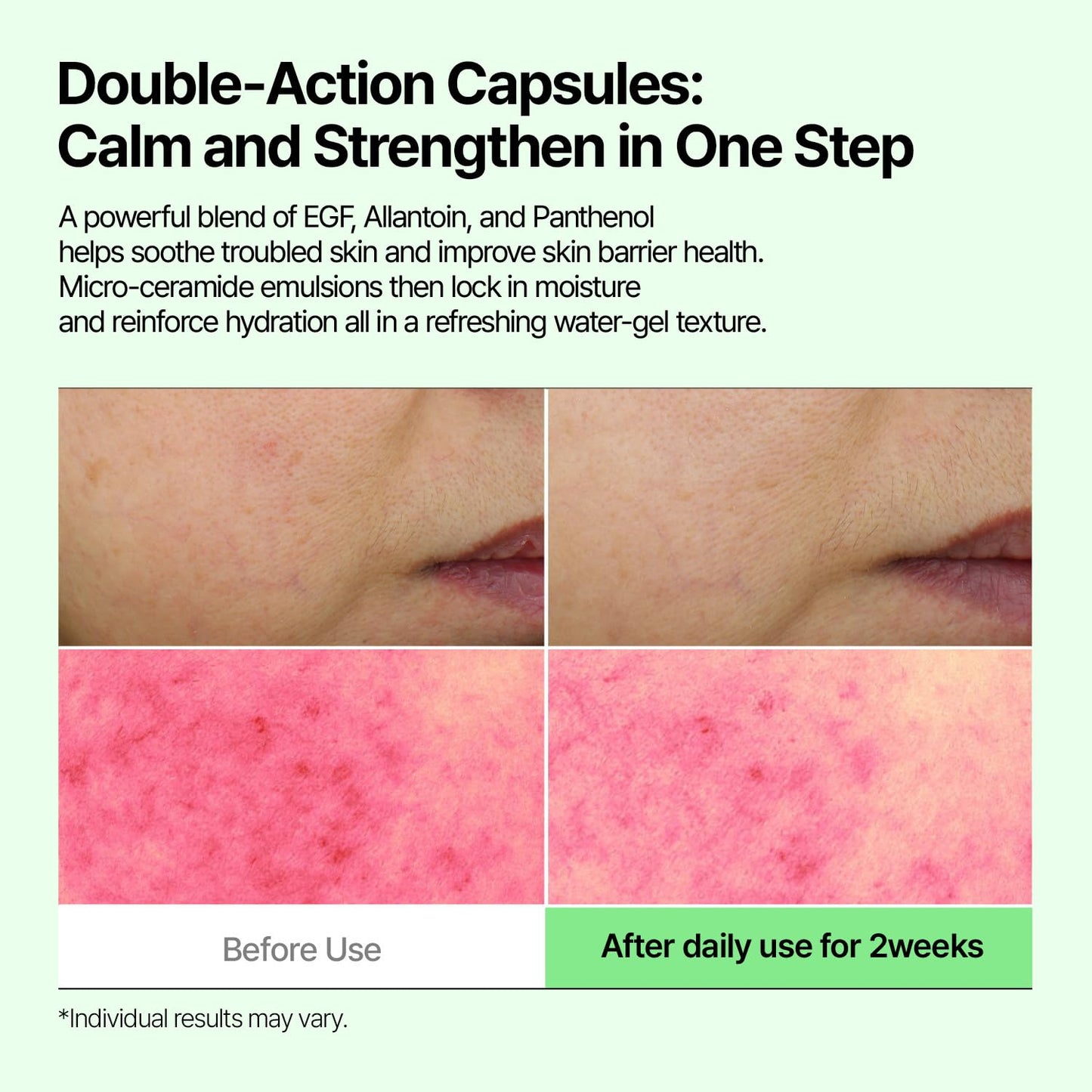 CELL IN SHOT EGF Allantenol Repair Ampoule - Soothing Facial Serum for Post-Blemish Recovery, Calming Hydrating Ampoule for Acne-Prone & Sensitive Skin, Korean Skin Care, 1.69 fl.oz. (50 ml)