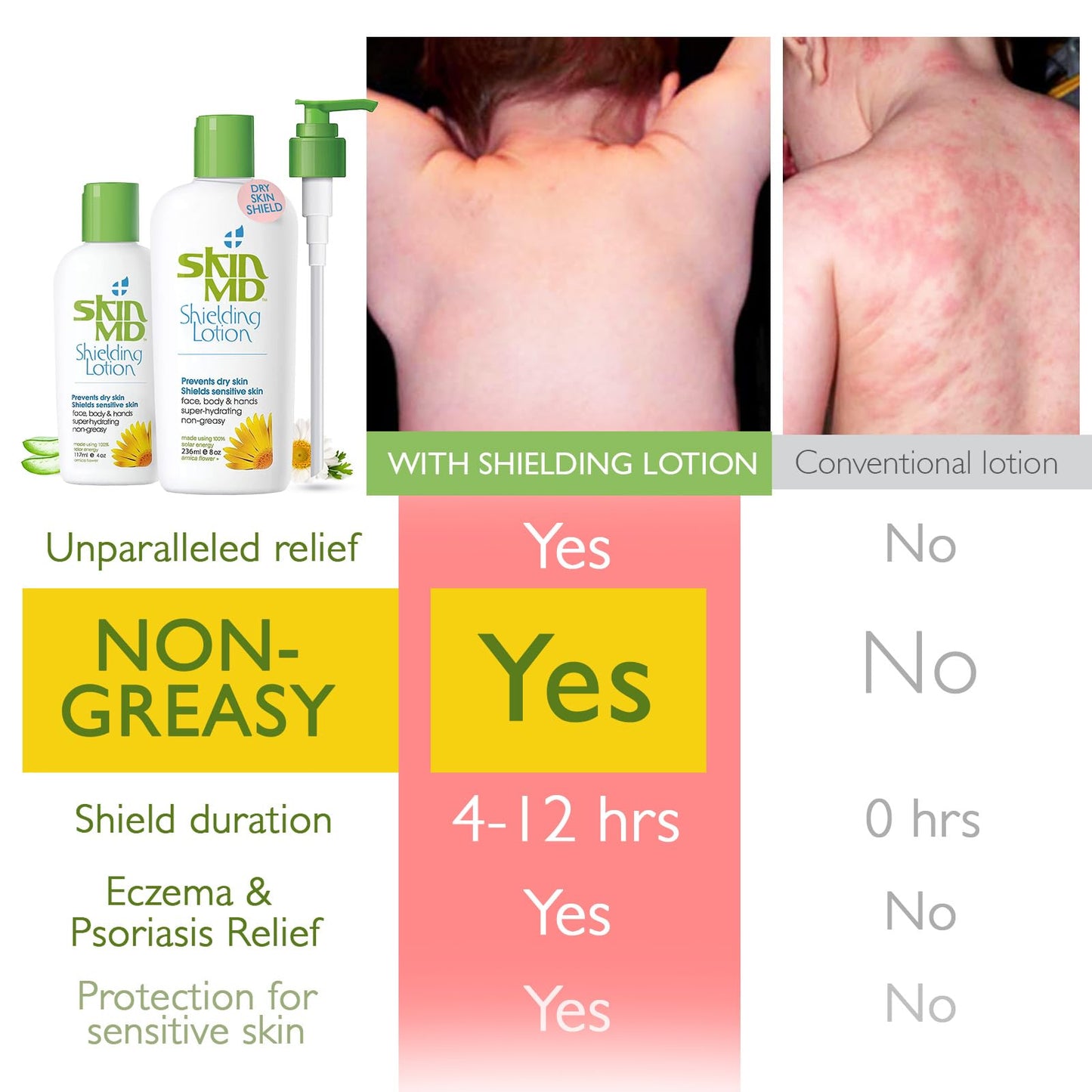 Skin MD Shielding Lotion Hydrating Body Lotion for Sensitive Skin with Dispenser | Non-Greasy, Fast-Absorbing Moisturizer with Plant-Based Ingredients, Eczema & Psoriasis Relief - 8oz + 4oz with Pump