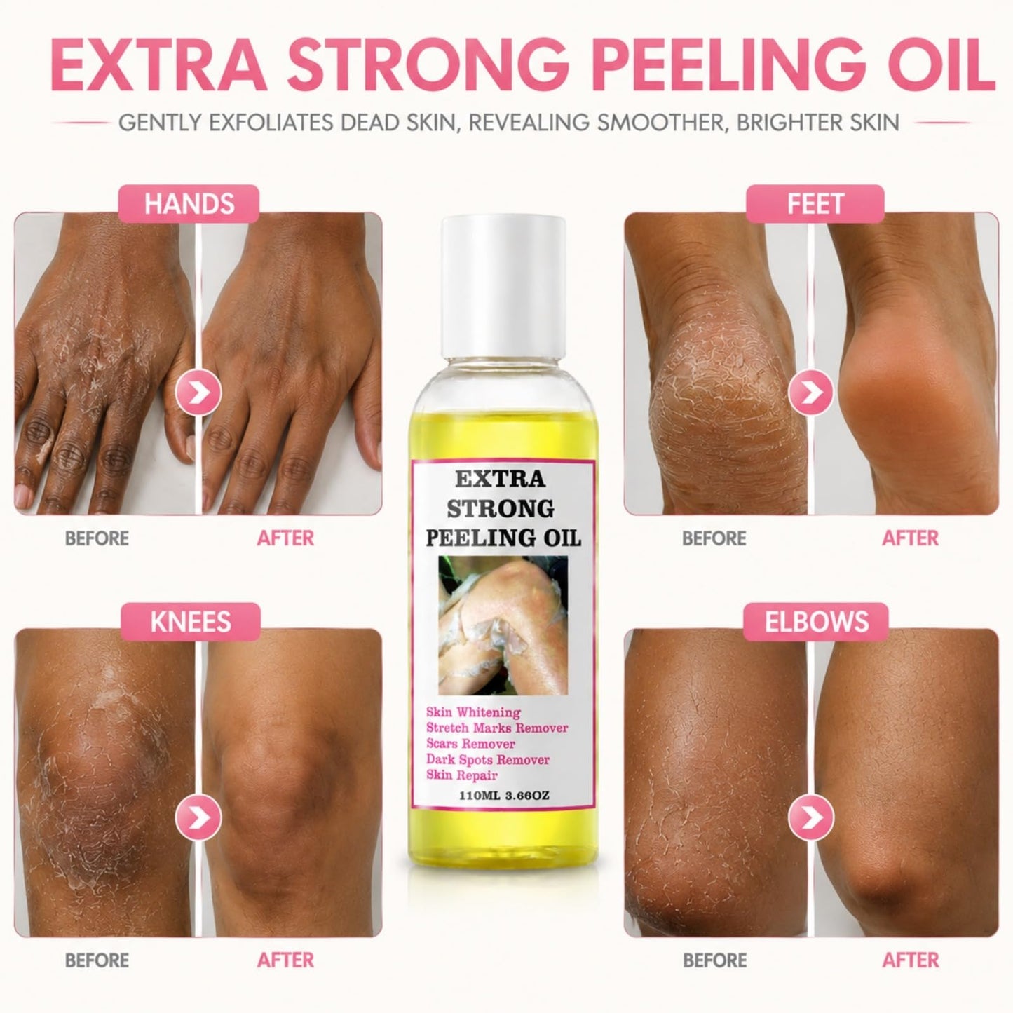 Yellow Peeling Oil for Dark Skin, Extra Strong Peeling Oil, Natural Formula Exfoliating Peels Solution for Face, Body, Hands and Foot Dead Skin Remover (220ML/7.76 OZ)