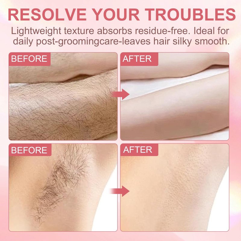EZBNG Renovia Cyperus Rotundus Oil, Renovia Hair Removal, Natural Cyperus Rotundus Oil for Hair Removal, Moisturizing & Soothing, Reduces Hair Growth, Safe for All Skin Types