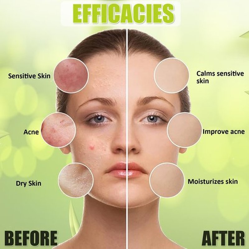 YMEYFAN Jelly Mask for Facials Professional, Plants Extract Hydro Jelly Mask Powder, Calm Sensitive Face Skin Care Peel Off Mask for Facial Vajacial, Esthetician Supplies, Vegan Ingredients Unscent