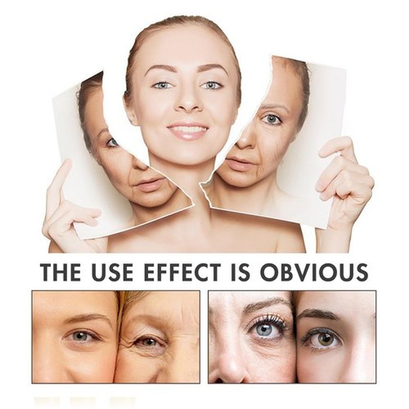 ESTEVO PDO Eyes Thread Lift, Improves Fine Lines and Wrinkles Get Youthful PDO Threads Lift for Eyes (20PCS-30G*25mm)