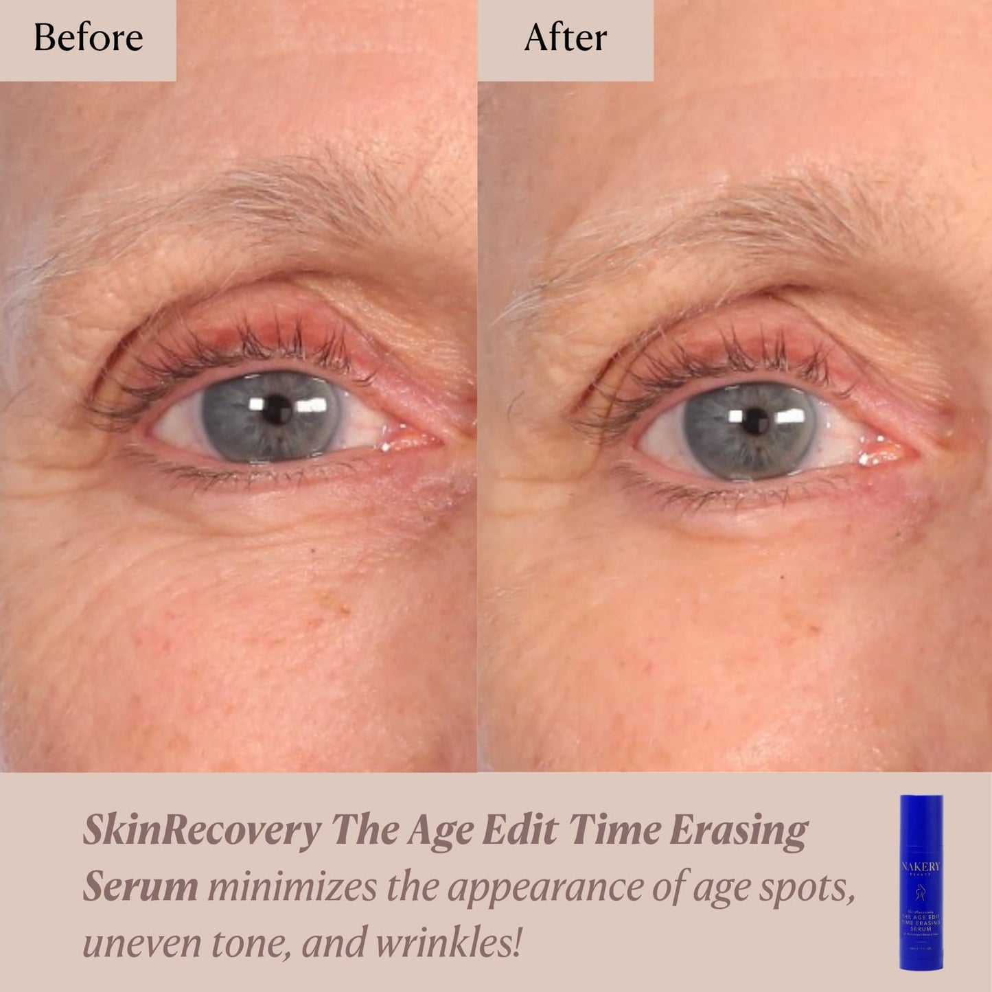 Nakery Beauty SkinRecovery The Age Edit Time Erasing Serum For Face, Anti Aging Exfoliating Serum With Multi Acid Blend And Magnesium, Helps Improve The Look Of Firmness Tone And Texture