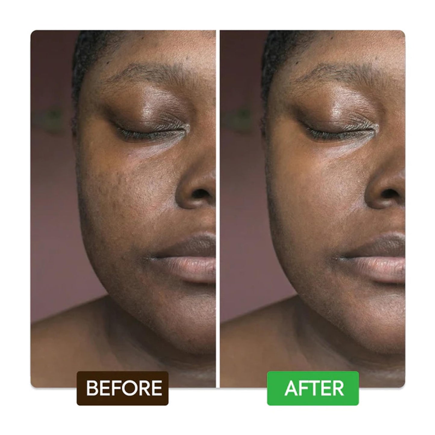 MAKARI Kojic & Azelaic Serum, Multi-Action Skin Care with 10% Azelaic Acid & 1% Kojic Acid, Targets Dark Spots & Uneven Tone, Lightweight Fast-Absorbing Daily Face Serum