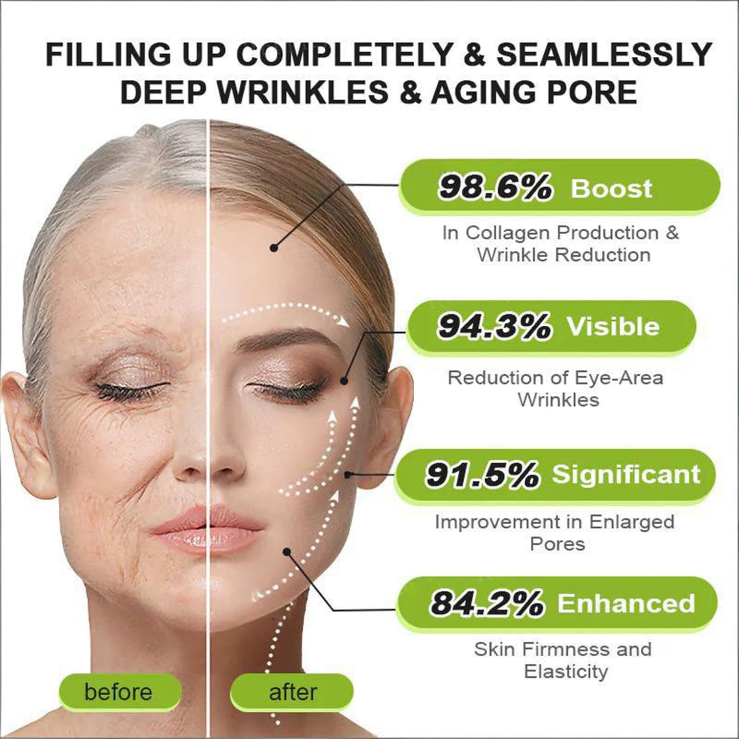 Rolimey Botoxmix & Vita-A Retinol Shot Wrinkle-Lift Tightening Cream, 2026 New Golden Peptide Lifting Cream, Pore Minimizer, Natural Collagen Lifting Serum for All Skin Types (2 Pack)