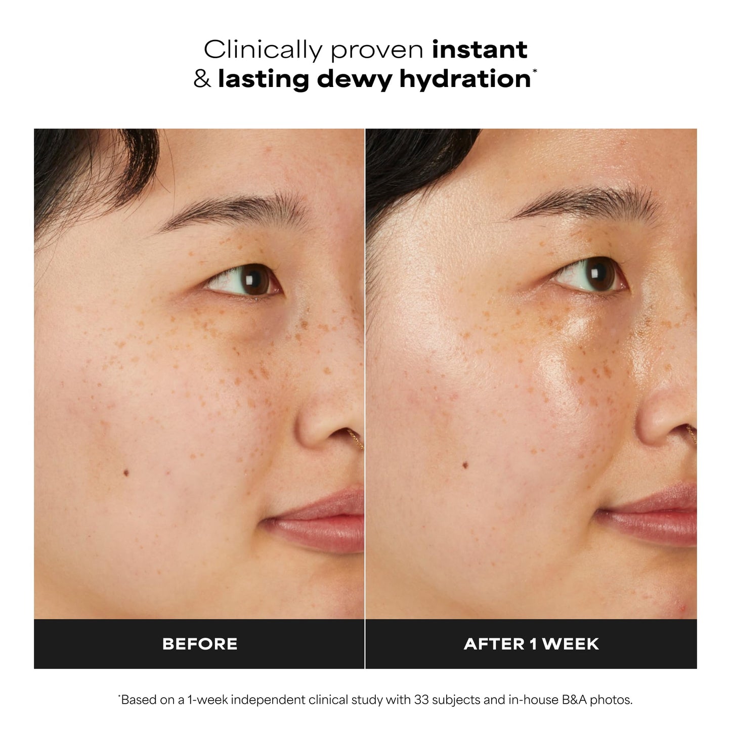 Paula's Choice 7% Ectoin + Hyaluronic Acid Hydrating Face Serum, 0.67 Fl Oz