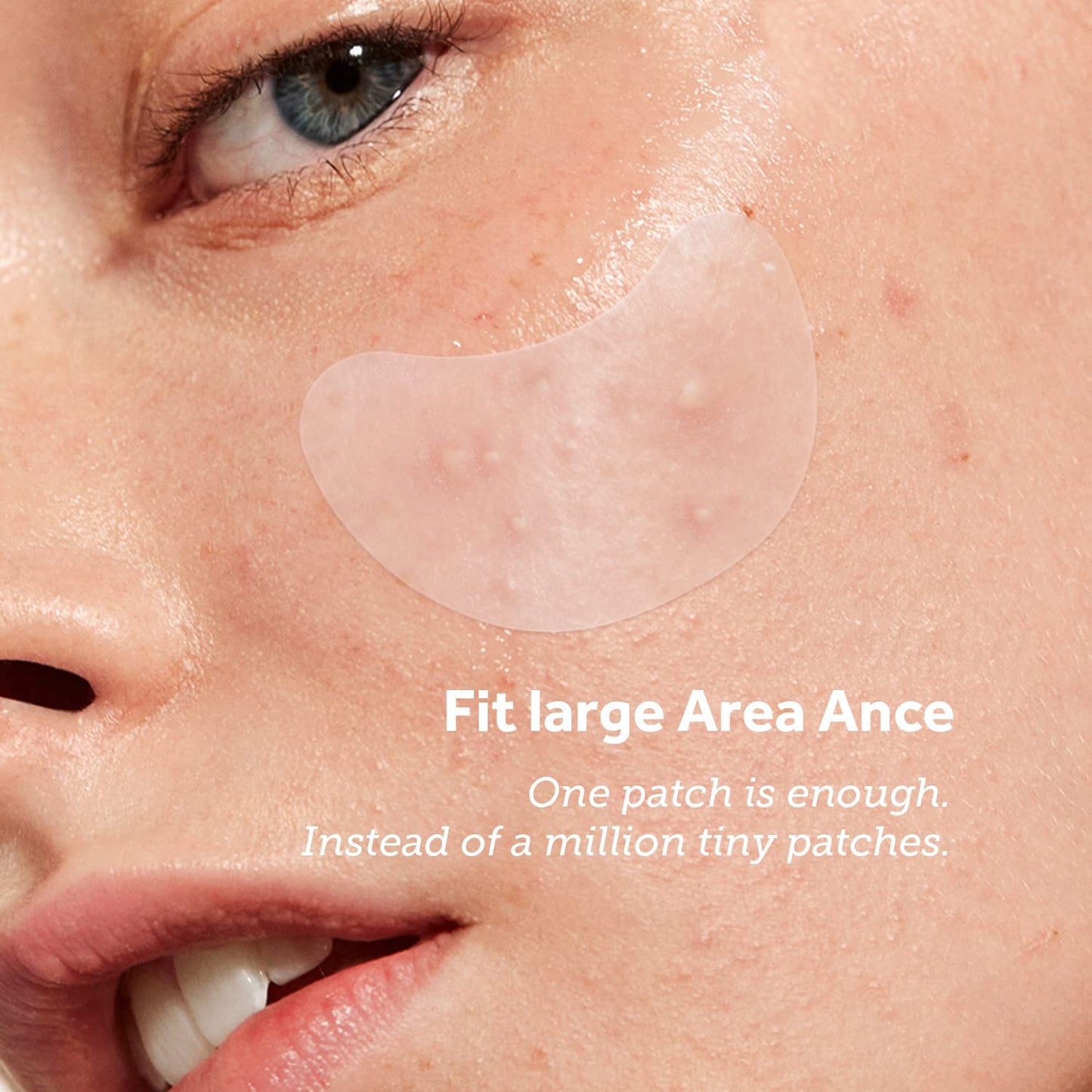 ZATKTK Pimple Patches (6 Sizes 138 Patches), Acne Patches for Large Zit Breakouts, Hydrocolloid Bandages for Face, Chin, Nose, Forehead, Body, Back, Neck & Chest, Oval Hydrocolloid Acne Patches