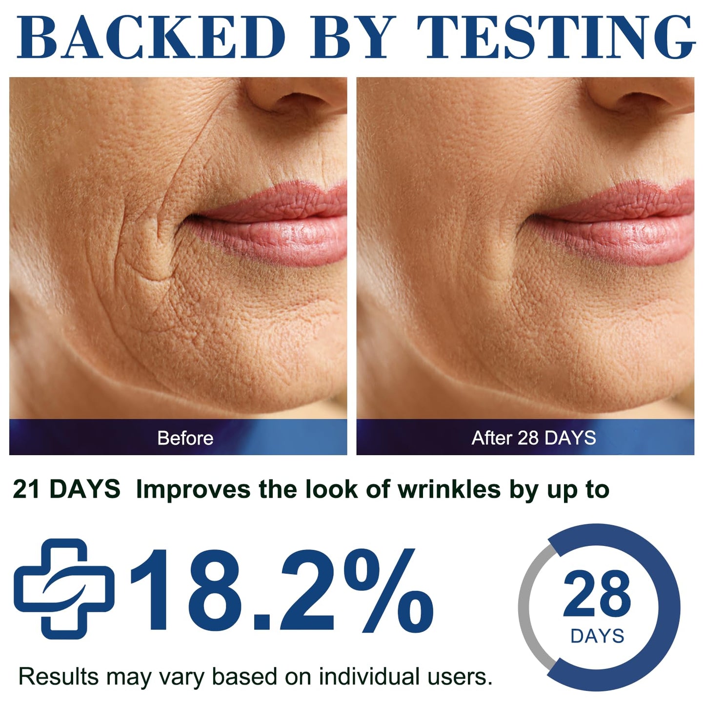 Line Blurring Wrinkle Filler | Marionette Lines Treatment City – Fill Beauty for Marionette, Smile & Fine Lines, Plumps, Hydrates, Firms Skin, Non-Invasive, Lightweight, 1.05 Fl Oz