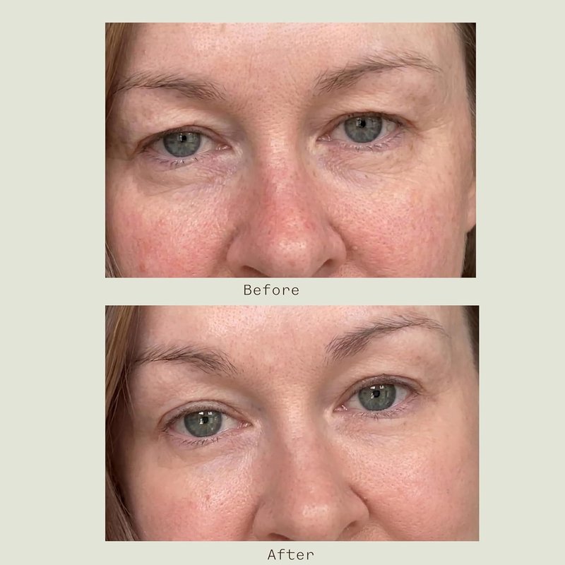 Under Eye Cream for Dark Circles - Caffeine & Peptides, Firming Anti-Fatigue Formula | 0.5 oz