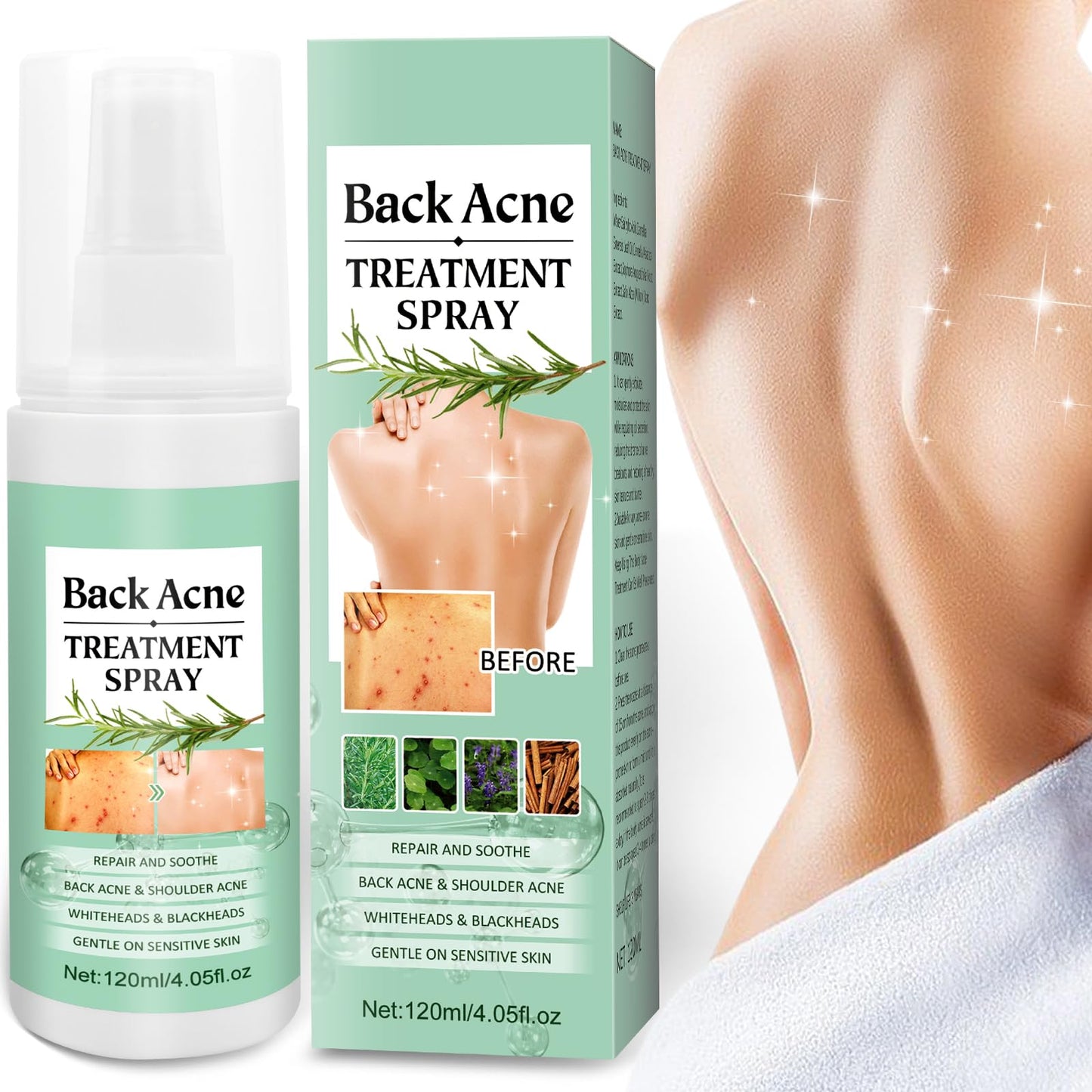 Back Acne Treatment Spray With Herbal Formula, 2% Salicylic Acid & Tea Tree Oil - Body Acne Solution, 120ml