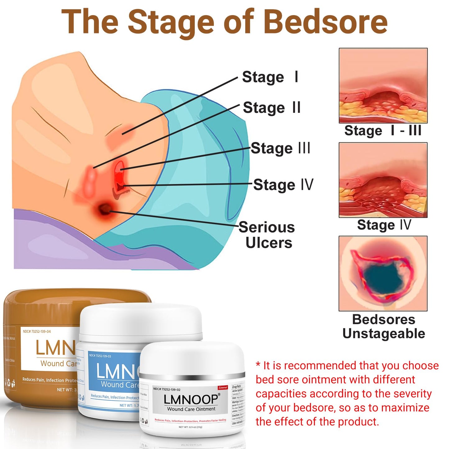 LMNOOP Bed Sore Cream, Organic Bedsore Ointment, Bed Sores Treatment, Fast Wound Healing & 24 hr Infection Protection Wound Care Ointment for BedSores, Pressure Sores, Diabetic & Venous Ulcers