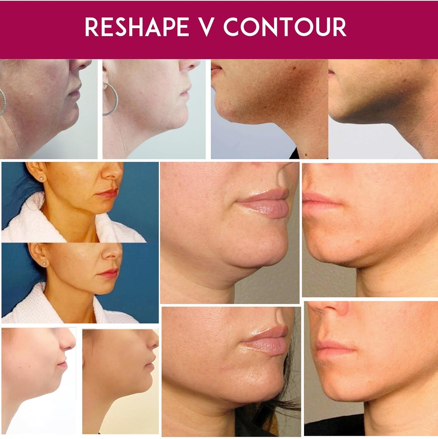 Anacis Advanced Set Neck Cream Serum Facial Belt Works for Visible Correction of Neck, Chin and Jawline - Fine Lines - Wrinkles - Sagging Skin (Serum Belt Cream)