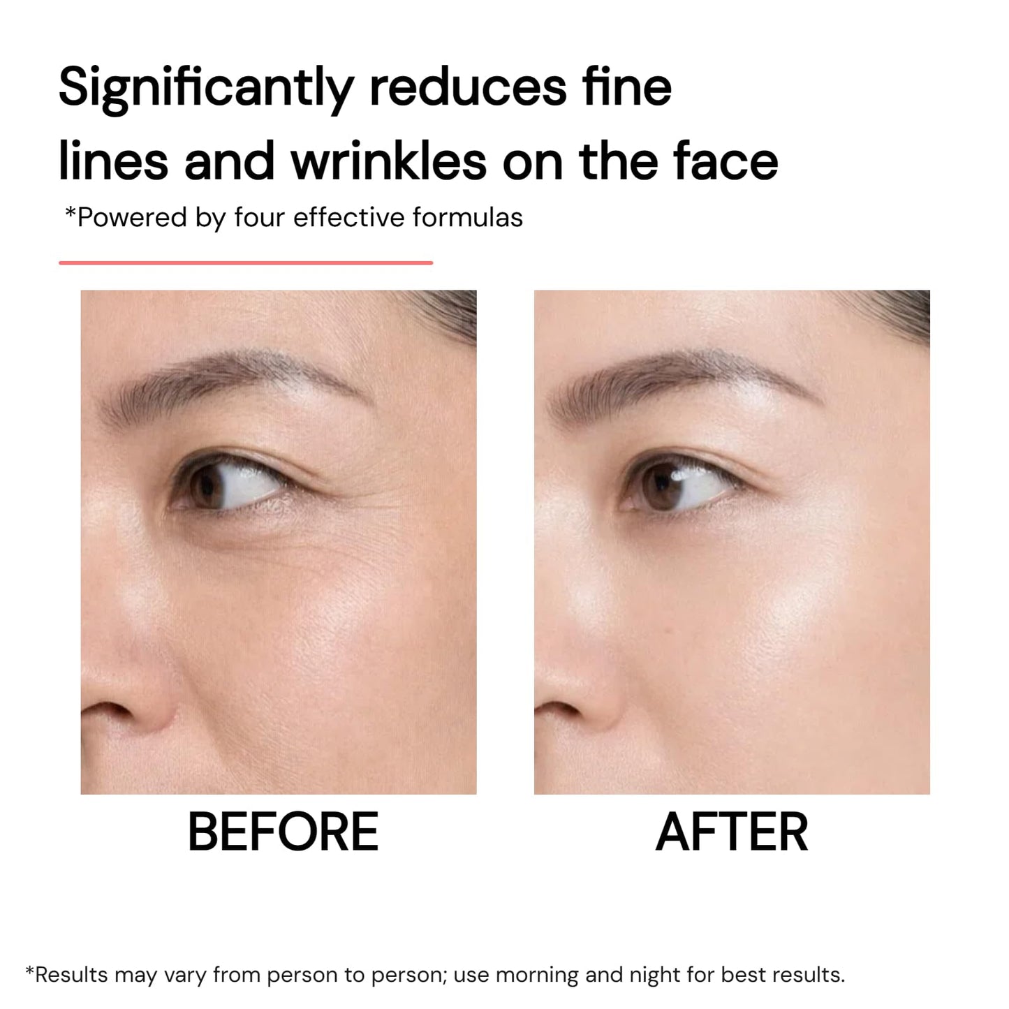 Retinol 1 + Pro-Xylane 5 Anti-Wrinkle & Firming Serum — Formulated with Squalane 8 Active Peptides, moisturiser Anti-Aging Firmness, Diminishing Wrinkles and Fine Lines,1.01fl.oz.