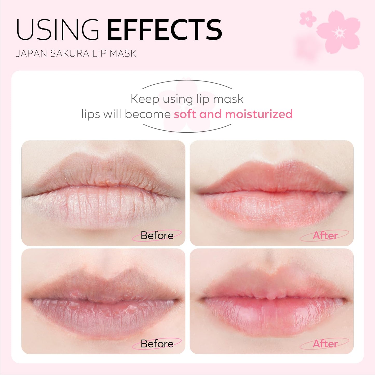 AKARY Sakura 10 Pieces Hydrating Lip Mask, Lip Sleep Mask Collagen Crystal Lip Care Gel Pads For Moisturizing, Minimize Fine Lines, Remove Dead Skin, Chapped Pads Lip Mask (10)