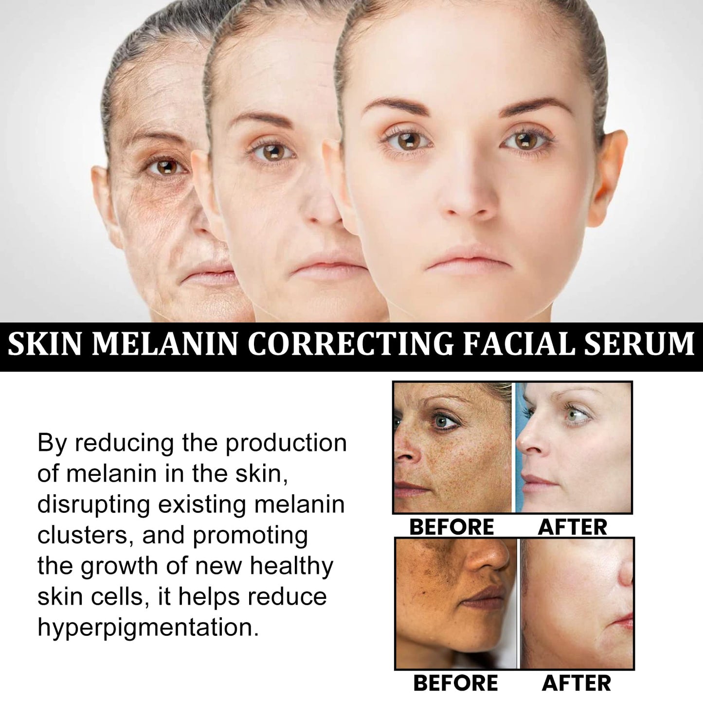 Melanin Correcting Facial Serum, Dark Spot Corrector Daily Face Serum, Melanin Correcting Facial (3pcs)