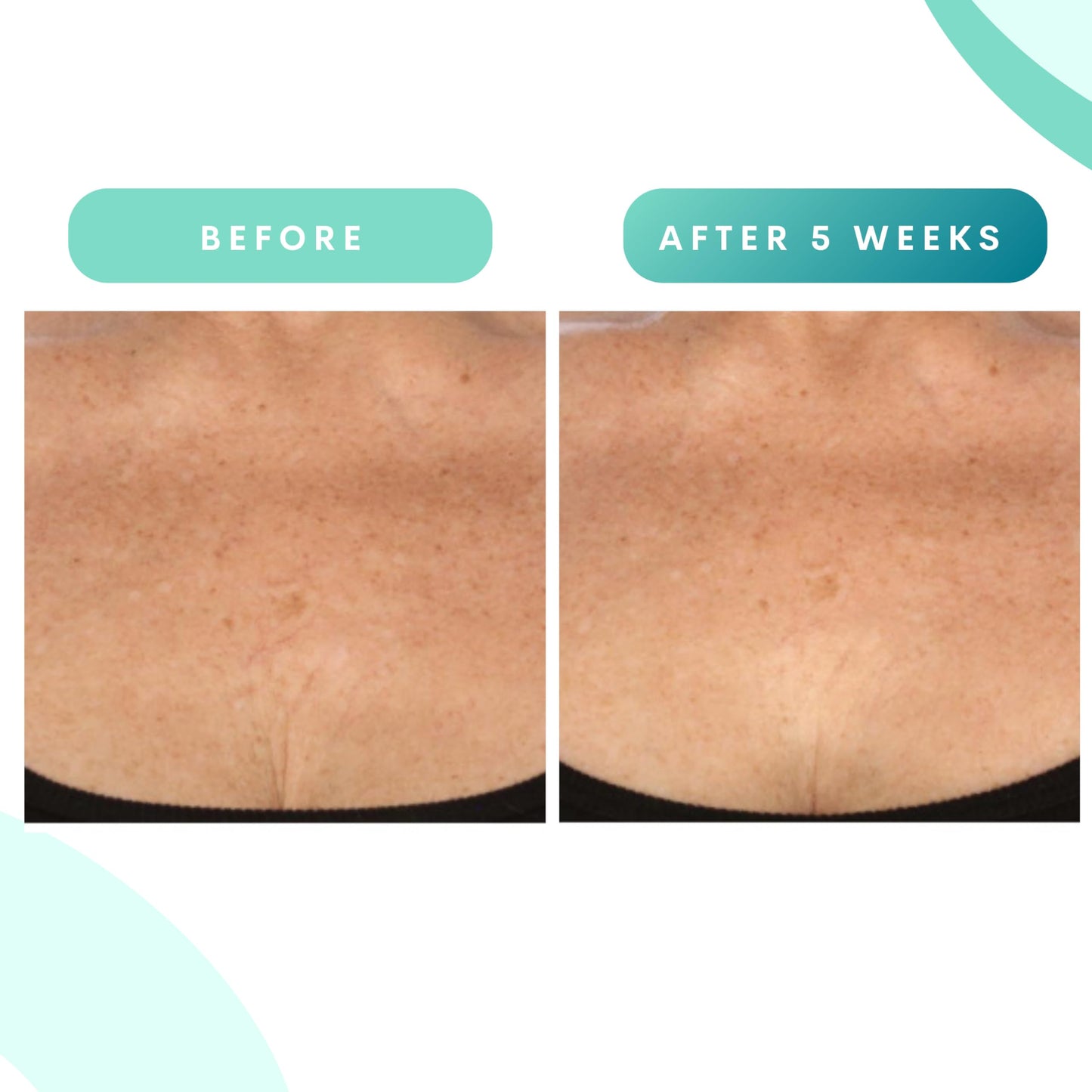 Serious Skincare, Glycolic Firming Retexturizing Body Cream with BODY FIT™, Moisturizing Lotion for Dry Skin, for Loose Crepey Skin Arms, Legs, Belly, Gentle Exfoliation for Smooth & Glowing Skin 8 Oz