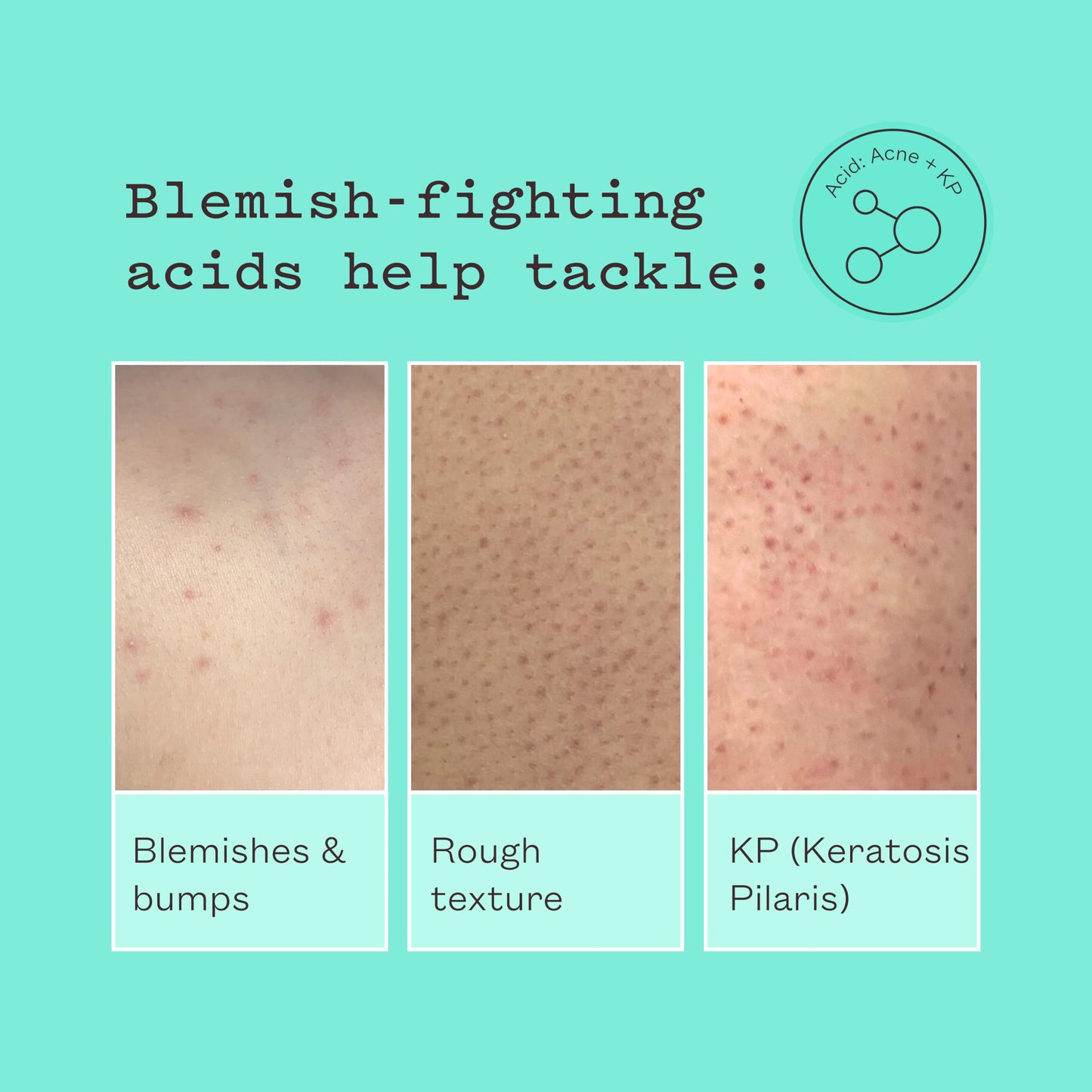 frank body Smoothing AHA Body Lotion | Gently Exfoliates to Smooth KP & Body Breakouts | With Lactic & Glycolic Acids, Hydrating Oils, Mango Seed Butter & Australian Botanicals | 140ml/4.73 fl oz