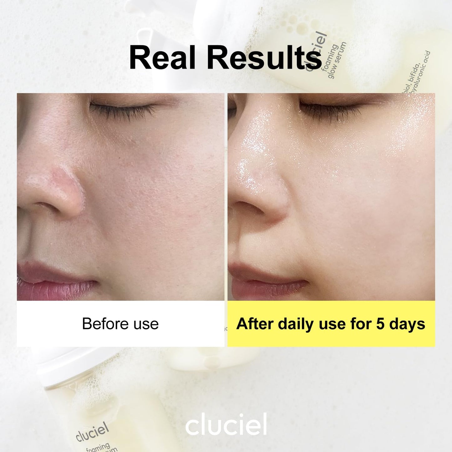 cluciel Foaming Glow Serum I Repairing Serum for Korean Glass Skin with Bakuchiol & Bifida, Smoothens Skin Texture, Balances Skin Tone, For Sensitive Skin, Fragrance-Free, Vegan (50ml / 1.69 fl.oz)