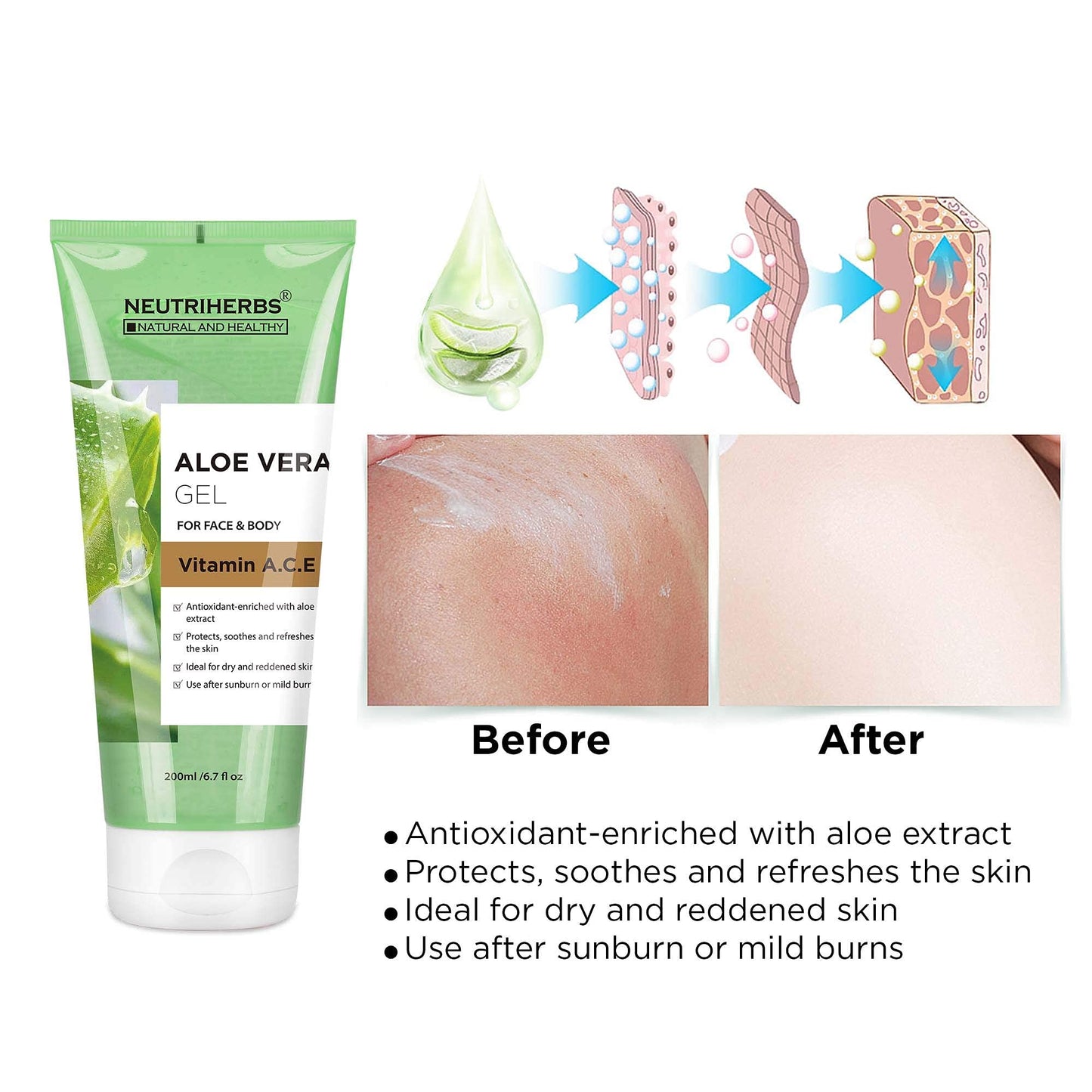 Neutriherbs Aloe Vera Gel Pure Aloe Vera Juice with Vitamin A, C, E for Sunburns Acne Dry Skin and Itch Soothing and Moisturing 6.7 Fl Oz