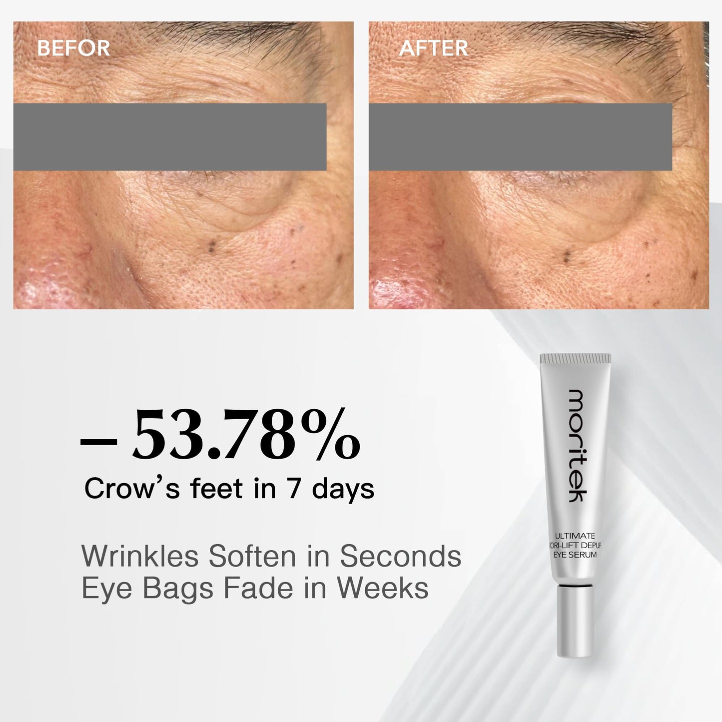 MORlTEK Deep Anti-Aging Wrinkle Remover & Eye Serum Visibly Reduces Under-Eye Bags, Puffiness, Dark Circles, Wrinkles, Fine Lines & Crow's Feet Instantly