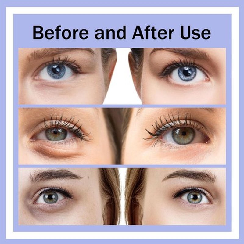 Botanique Paris Under Eye Device, Revitaleyes Under-Eye Therapy, Revital Eyes Glasses, Fade Dark Circles, Under-Eye Bags, Wrinkles, Fine Lines, Don’t Mask Aging, Rejuvenate It (2PCS)