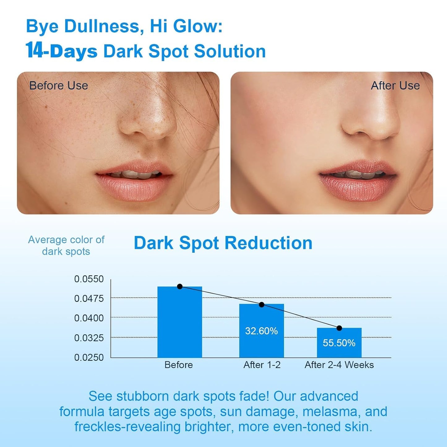 Dark Spot Remover for Face, Dark Spot Corrector, Dark Spot Serum for Sun Spots, Age Spots, Brown Spots,Acne Scars,Melasma Brown Spot -Advanced Formula with Niacinamide Vitamin C (1 Fl Oz (Pack of 1)