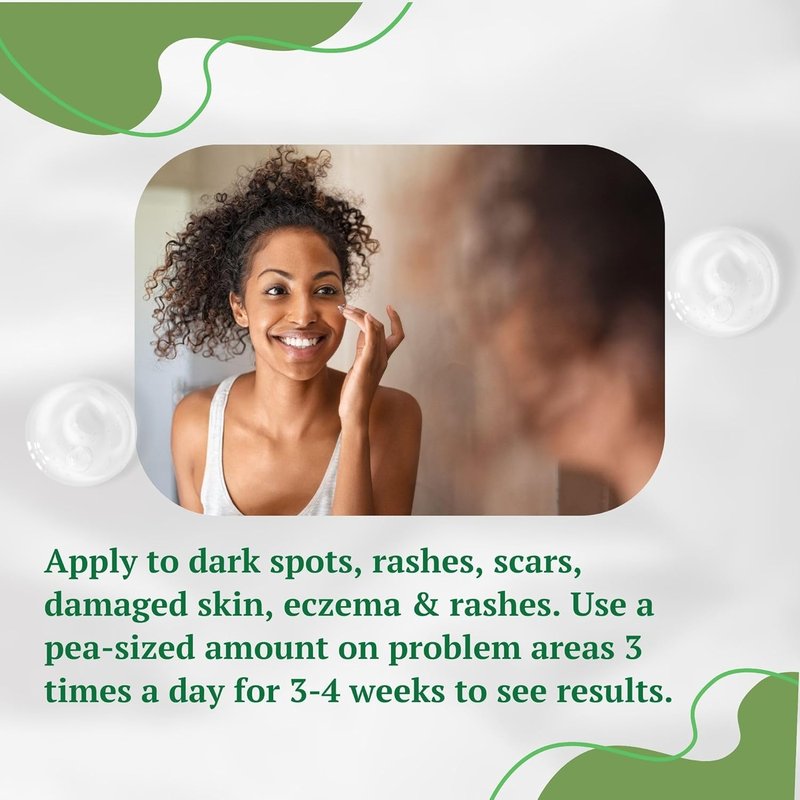 Aloe Vera Cream - Dark Spot Remover for Scars & Blemishes | Hydrating Face & Body Moisturizer for All Skin Types