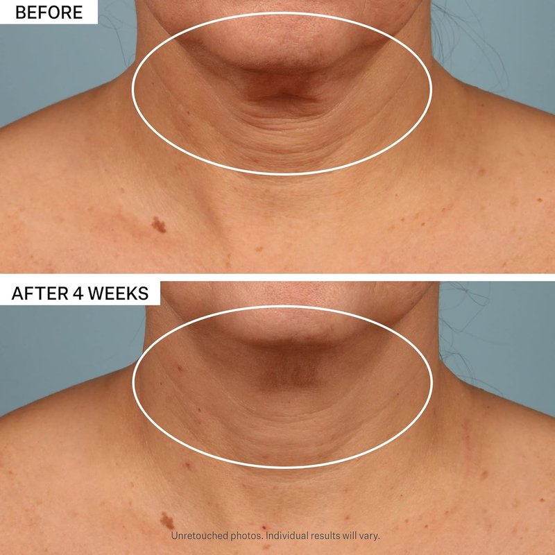 StriVectin Neck Cream - Tighten & Lift with Alpha-3 Peptides™ | Smooth Wrinkles & Fine Lines, 1.7 oz