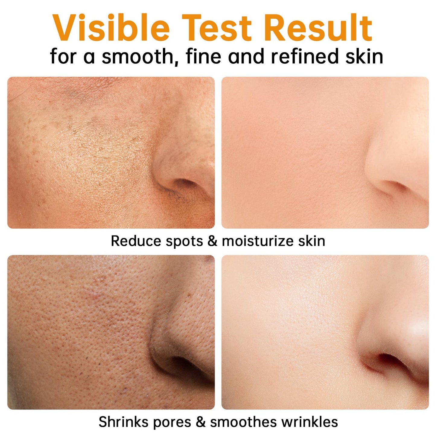 Turmeric Serum for Face, 30 ML/ 1 PCS Anti Aging Turmeric Facial Serum, Turmeric Oil, Moisturizes & Firms Skin, Reduces Wrinkles & Fine Lines, Skin Care Essence for Dryness, Hydrates Face