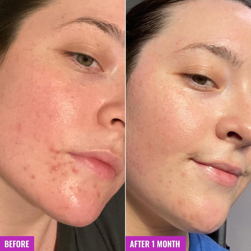 Good Molecules Clarify & Cleanse Bar | Soap-Free Salicylic Acid Cleanser for Balanced Skin Tone - Body & Face Use