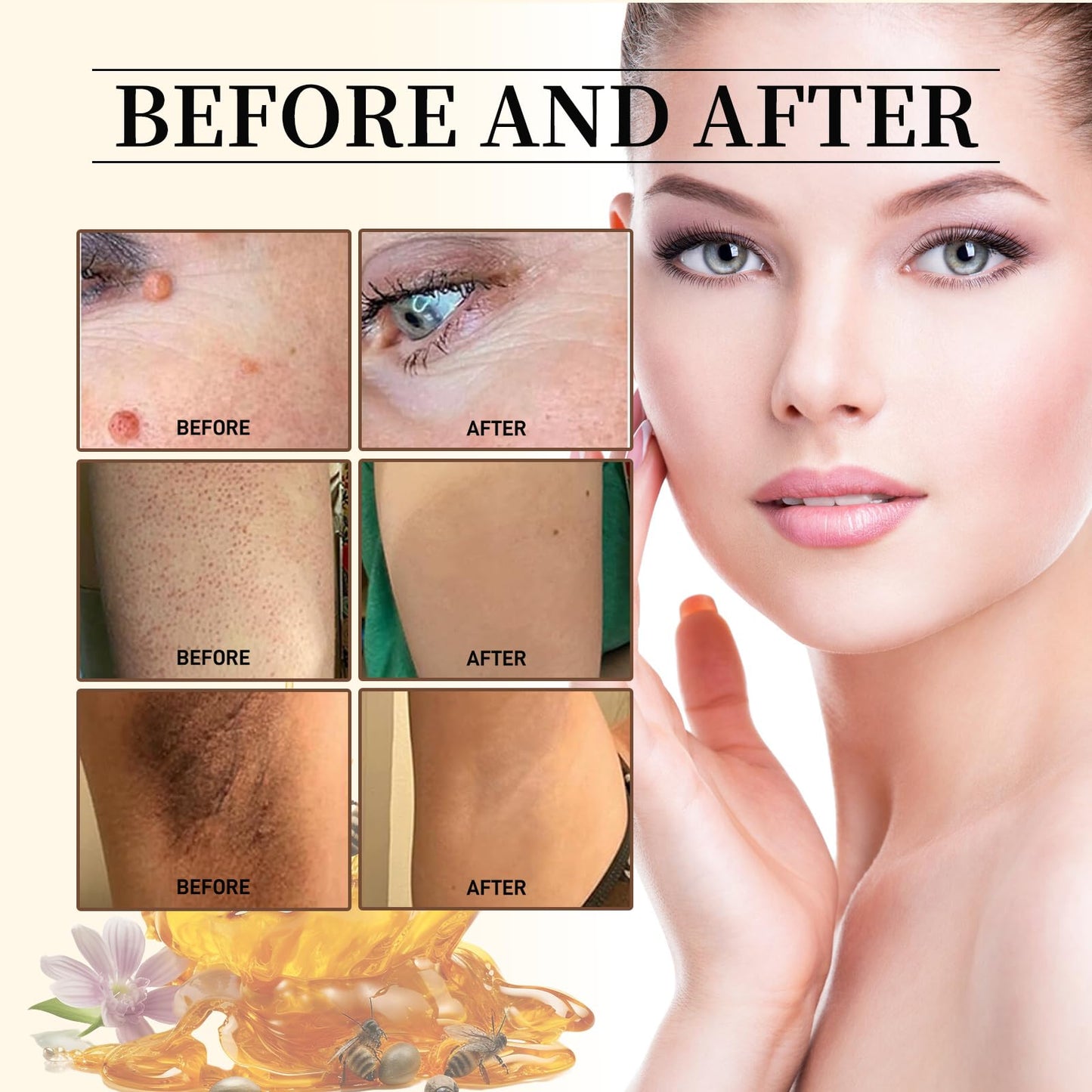 Bee Venom Repair Cream,Bee Venom Moisturizing and Nourishing Cream,Professional Bee Venom Repair Cream,Bee Venom Treatment Cream for All Parts of The Body,Suitable for All Skin Types of Men and Women