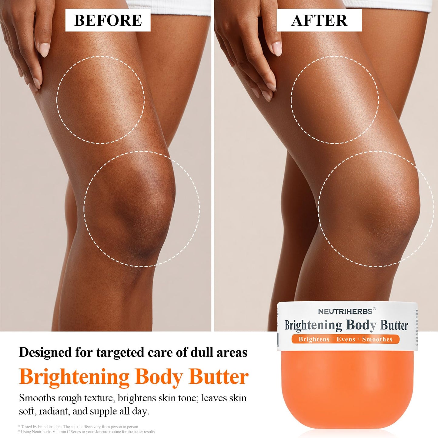 Neutriherbs Brightening Body Butter 280G – Moisturising Body and Radiant Dull Skin Body Cream for Dark Underarms, Knees & Elbows – Niacinamide, Arbutin & Shea Butter Dry Skin Moisturiser