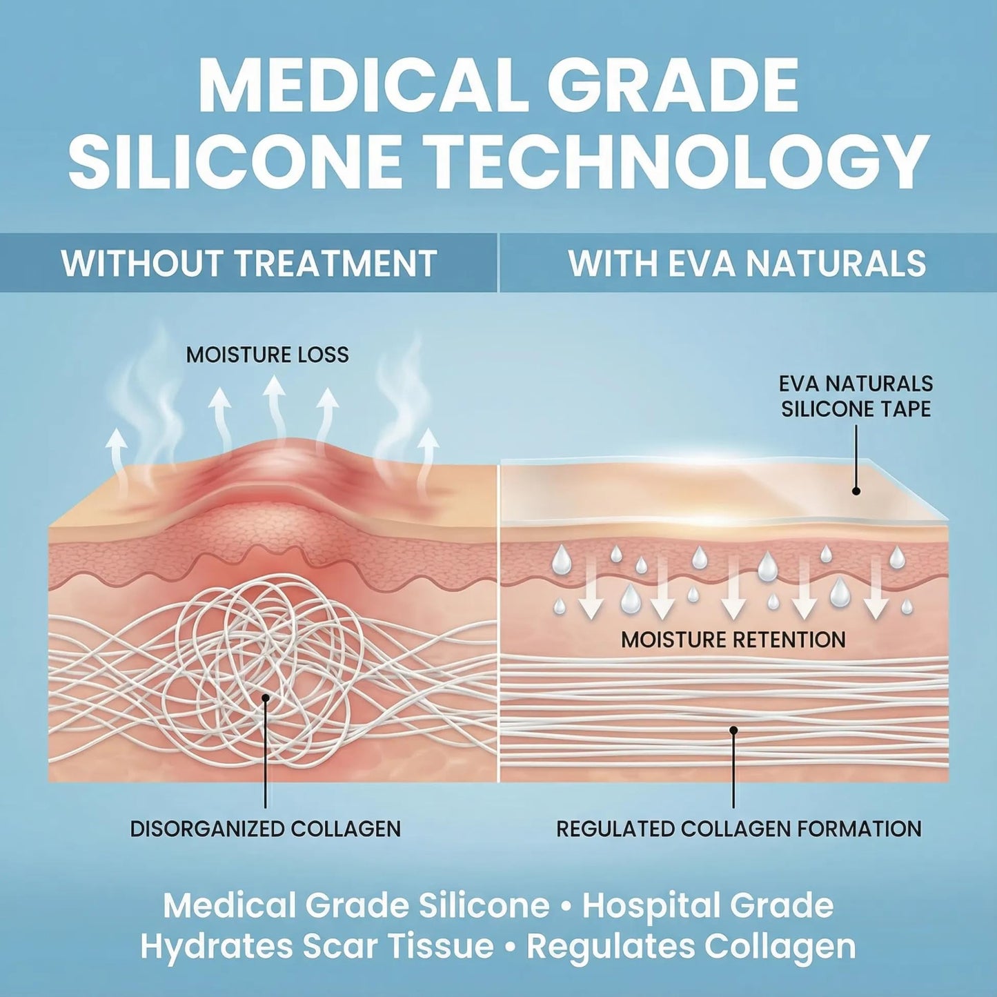 Soft, Medical Grade Silicone Tape for Scars (1.6” x 120”) - Reduce The Appearance of Surgical, C Section, Hypertrophy, Keloid Scars, & Acne Scars - Silicone Scar Tape for Surgical Scars, (3 Pack)