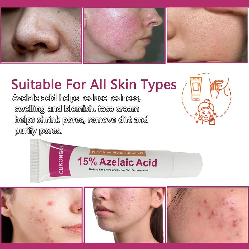 Azelaic Acid Serum - Balance Skin Tone & Cleanse Pores | Relieve Acne, Blackheads & Redness - 20g (1 PCS)