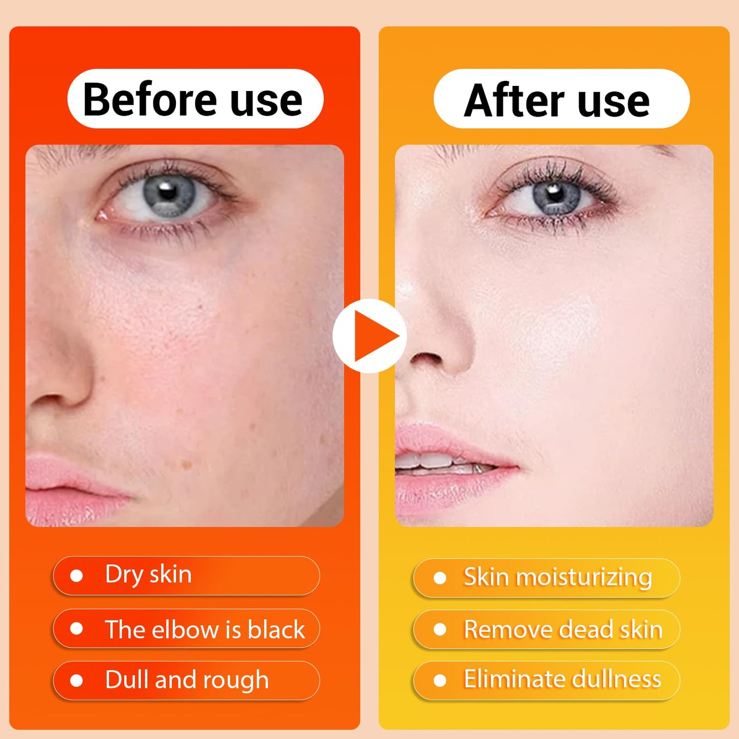 Peel Shot Keratin Care Kojic Acid Turmeric Spray 100ml - Exfoliating Body Spray with Retinol, Niacinamide for Face & Body for All Skin Types