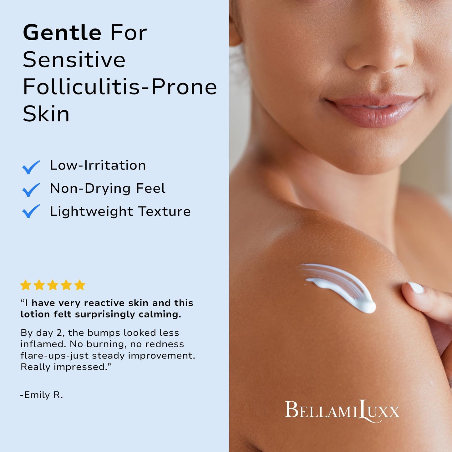 BellamiLuxx Folliculitis Acne Lotion for Body: Helps Reduce Itch, Redness, Body Acne, Bumps & Uneven Texture with Salicylic & Glycolic Acid + Botanicals - Gentle Care for Folliculitis-Prone Skin