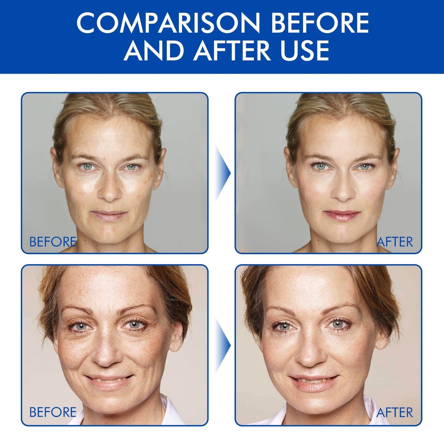 West Month Firming Facial Serum, Skincare Stock Solution, Stock Solution Facial Serum, Wrinkle & Fine Line Reducer, Anti-Aging Deep Wrinkle Repair Serum for All Skin Types (2PCS)