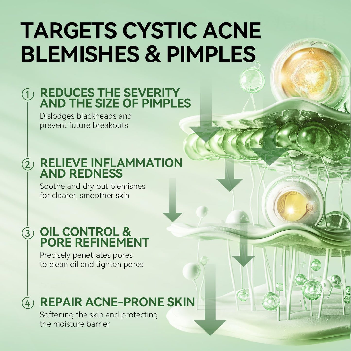 LANBENA Precision Acne Spot Serum, Acne Drying Lotion, Overnight Acne Treatment For Face, Dry Out Pimples, Blemishes, Zits And Clean Pores, 0.43 Fl Oz