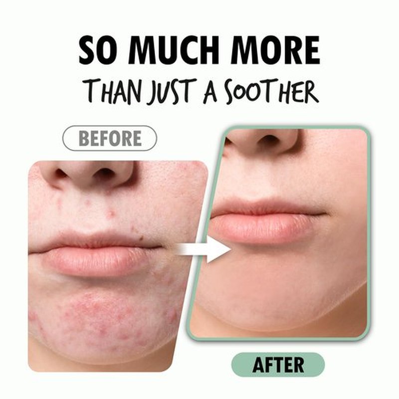 POUR LA PEAU Calming Cica Serum | Centella Asiatica Serum for Face | Organic Face Moisturizer Centella Ampoule | Hypoallergenic & Hydrating Face Serum Korean Skin Care Products (1.01 Fl. Oz)