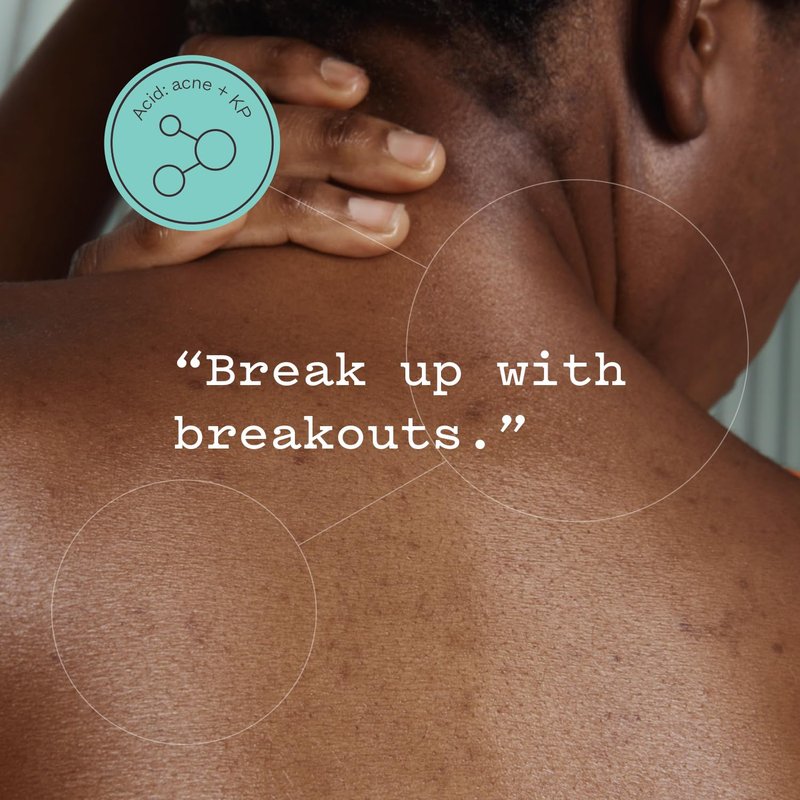 Glycolic Acid Body Scrub - Exfoliating Treatment for KP, Breakouts & Pore Tightening | 8.82 oz