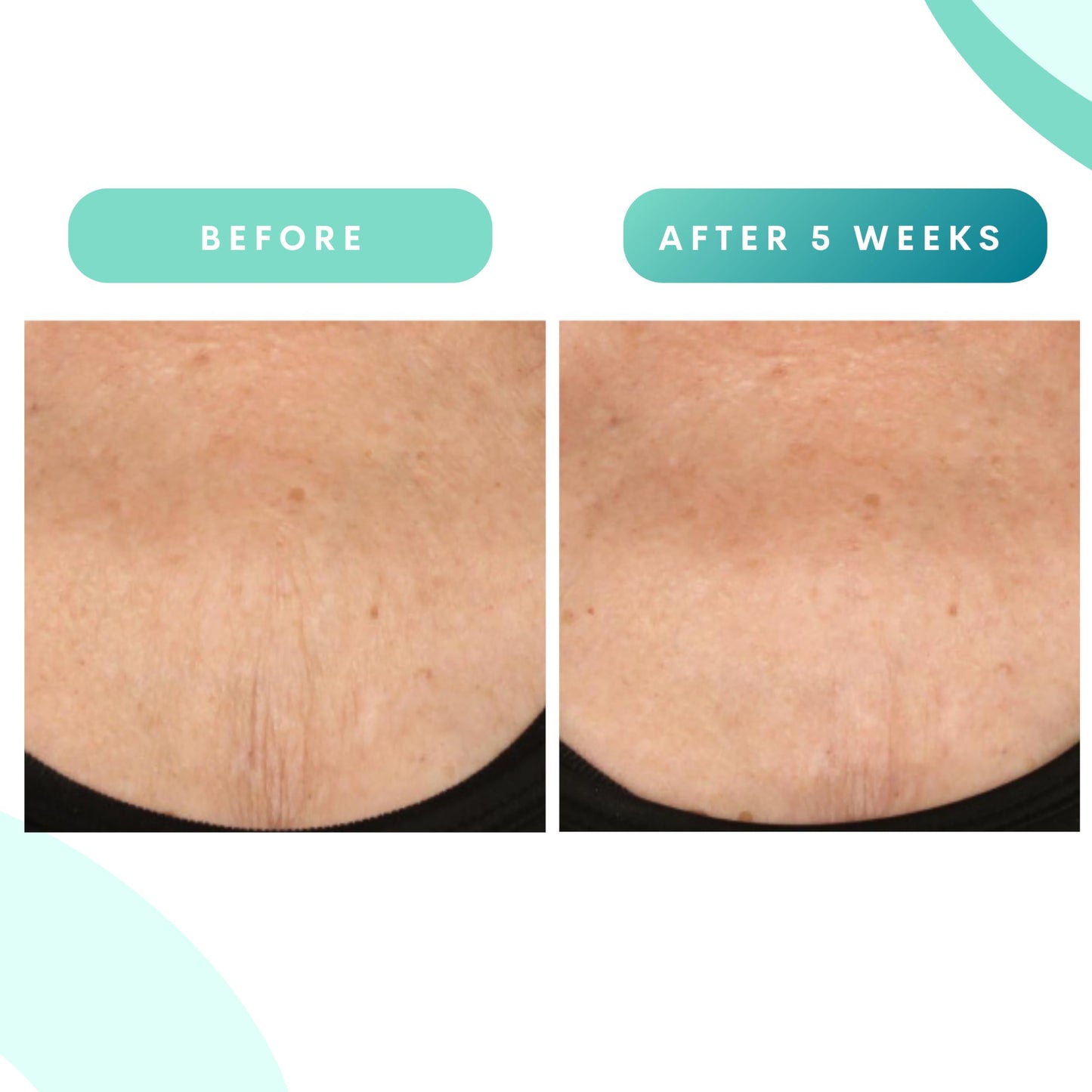 Serious Skincare, Glycolic Firming Retexturizing Body Cream with BODY FIT™, Moisturizing Lotion for Dry Skin, for Loose Crepey Skin Arms, Legs, Belly, Gentle Exfoliation for Smooth & Glowing Skin 8 Oz