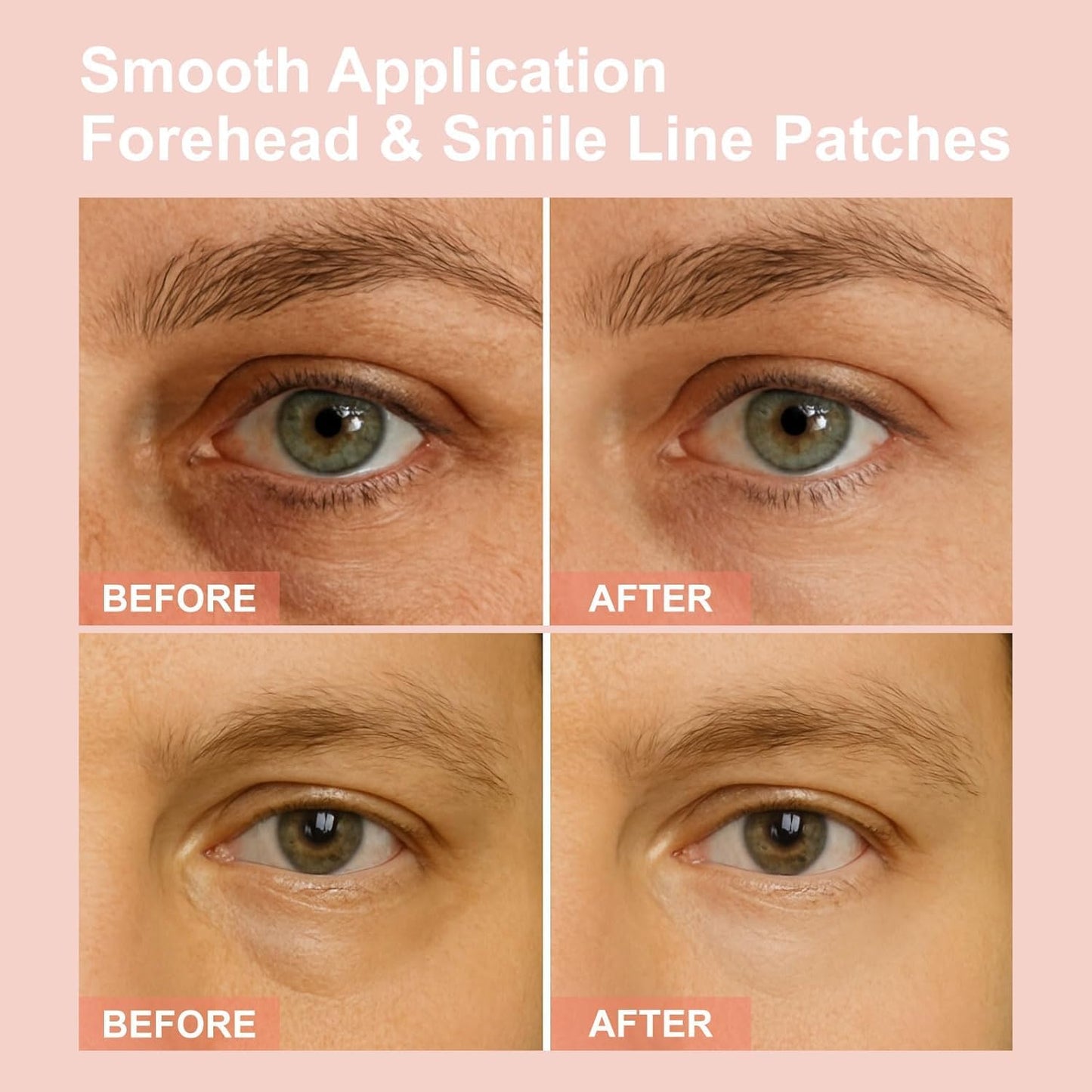 NOVALIFT Micro Eye Patches, Deeply Hydrating Anti-Wrinkle Patches, Contains Hyaluronic Acid and Collagen for Dark Circles, Smooth Application Forehead & Smile Line Patches for Women (1)