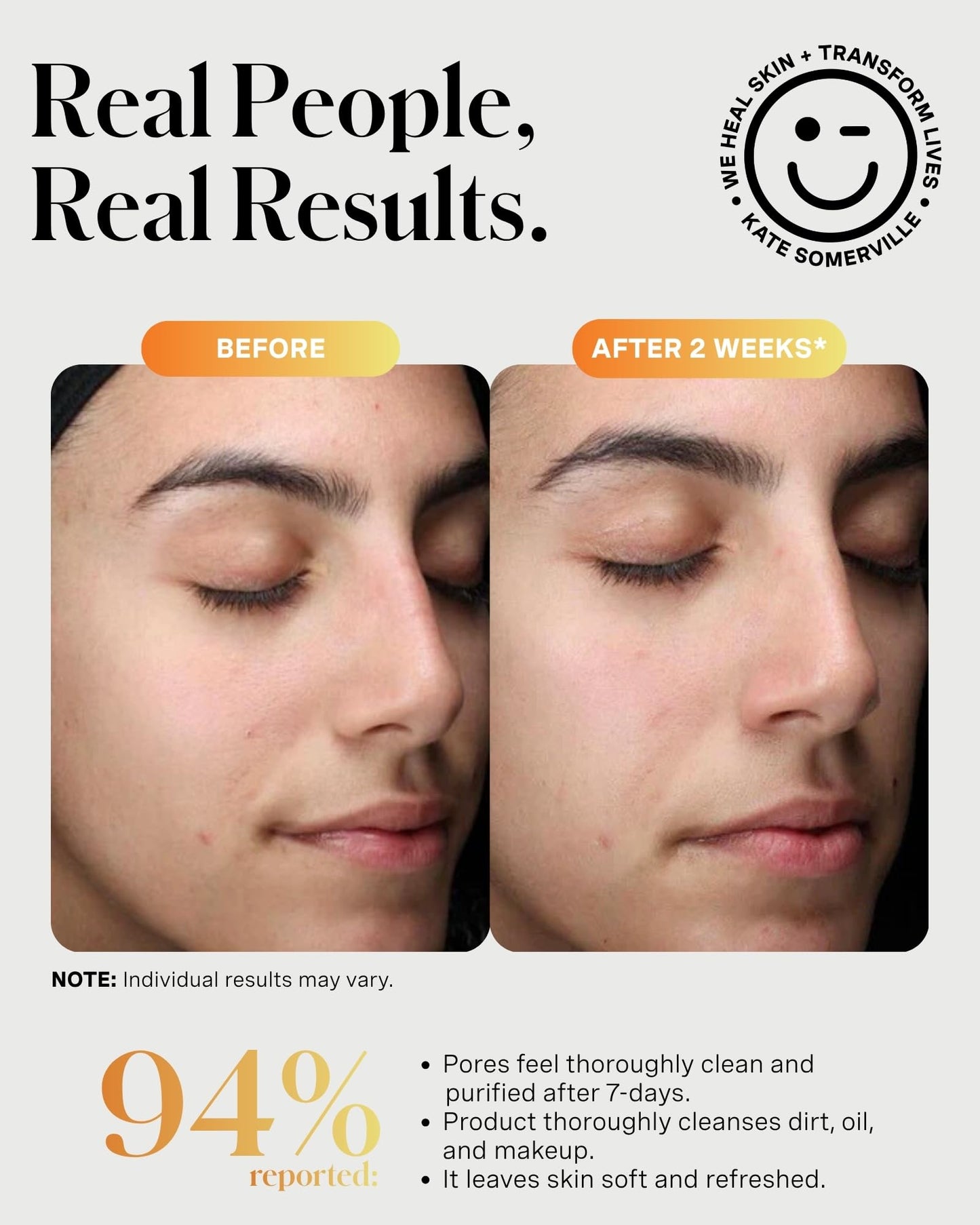 Kate Somerville ExfoliKate Cleanser – Daily Exfoliating Foaming Face Wash, Clinically Formulated Glycolic Acid and Lactic Acid Gentle Facial Scrub, Travel-Size, 1.7 Fl Oz