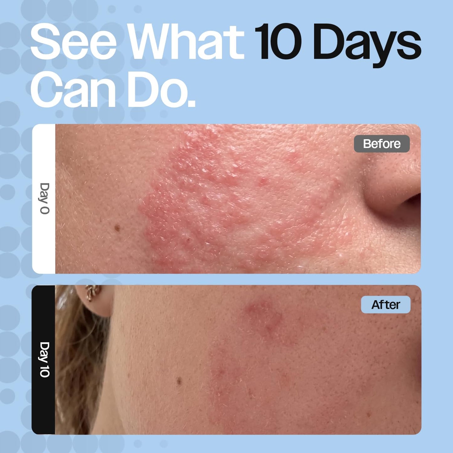 CELRIV Barrier Repair Cream for Dry, Sensitive & Eczema-Prone Skin, Clinically Proven +300% Hydration, Lightweight Non-Greasy 24HR Moisturizer, Dermatologist Tested, EWG VERIFIED™, Fragrance Free